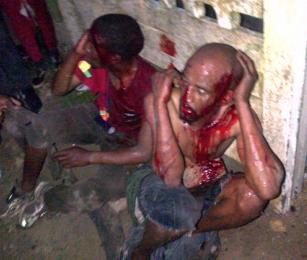 The two men who were beaten up. Photo by Pharie Sefali. The two men who were beaten up. Photo by Pharie Sefali.