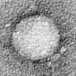 Electron micrograph of Hepatitis C virus. Source Wikipedia. Electron micrograph of Hepatitis C virus. Source Wikipedia.