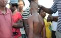 A 14 year old child shot by rubber bullets. Photo by Kate Stegeman.
