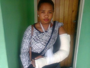 Photo of Unathi Mantashe with her arm in plaster