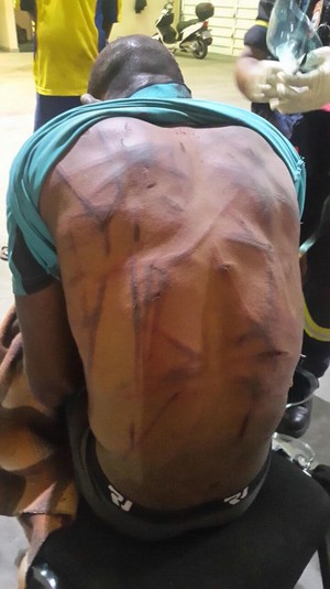 Photo of man with injured back.