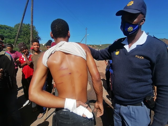 Photo of a man showing back injuries and a police man
