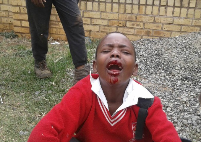 Photo of wounded boy